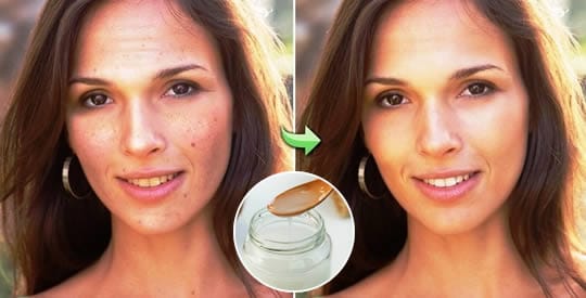 Crema viso per le rughe